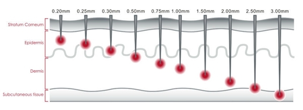 dermaroller-needle-sizes.jpg